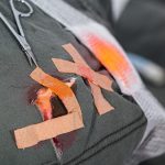 urupedia media urup Sering Terjadi Kecelakaan! Ini Cara Perawatan Luka di Rumah